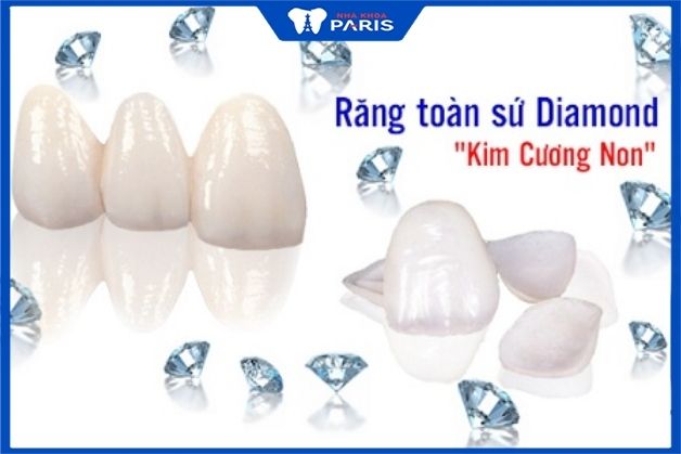 Răng toàn sứ kim cương Paris nên bọc răng sứ loại nào