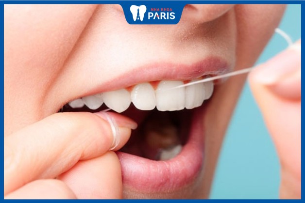 Chỉ nha khoa giúp làm sạch răng miệng hiệu quả