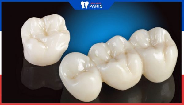 Răng sứ cercon sử dụng được bao lâu? 4 giải đáp từ nha sĩ