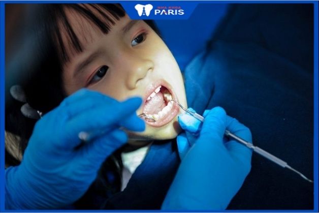 Tiêu chí lựa chọn địa chỉ nhổ răng sữa cho bé đảm bảo