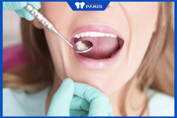 Top 10 bệnh về răng miệng thường gặp nhất mà bạn không thể bỏ qua