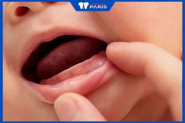 Cách bổ sung canxi cho trẻ chậm mọc răng và lưu ý quan trọng