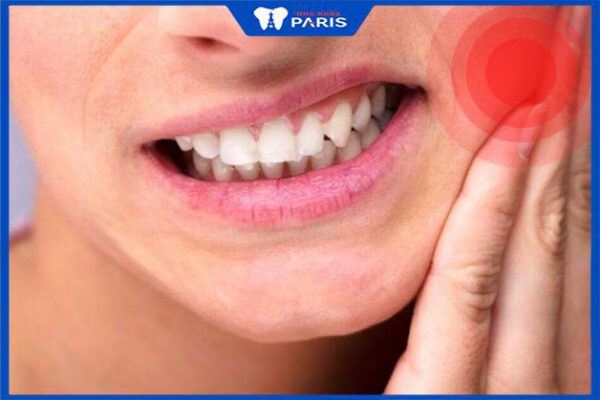 Bỏ túi cách giảm đau răng hàm tại nhà, khi nào cần đến gặp nha sĩ?