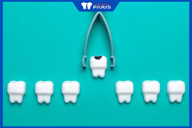 Nhổ răng cửa có đau không, so với răng khác thì thế nào?