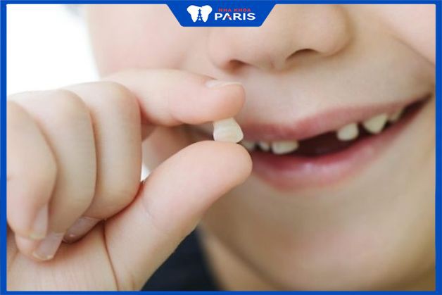 Nhổ răng sữa bao lâu mọc lại răng mới?