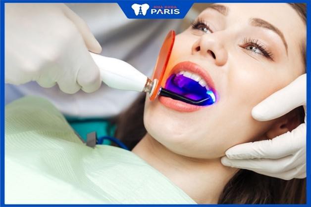 Tẩy trắng răng có đau không khi chiếu tia laser?