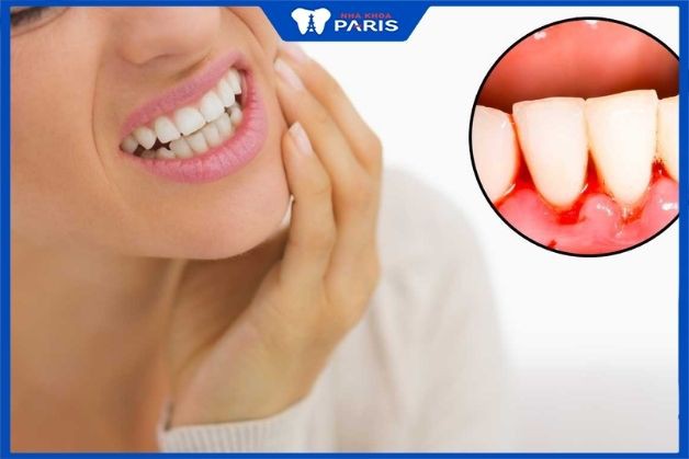 Viêm chân răng gây ra những ảnh hưởng nghiêm trọng nào?