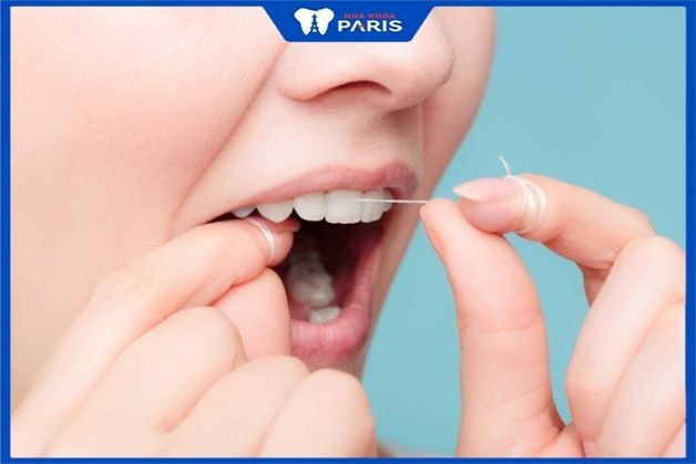 Chỉ nha khoa giúp làm sạch răng miệng hiệu quả Viêm chân răng phải làm sao