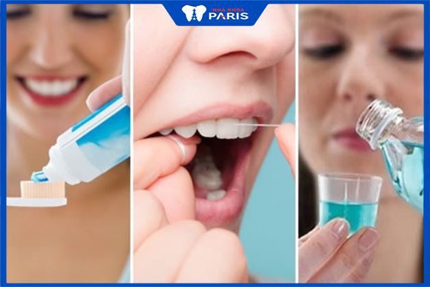 Vệ sinh răng miệng sạch sẽ giúp ngừa viêm nướu