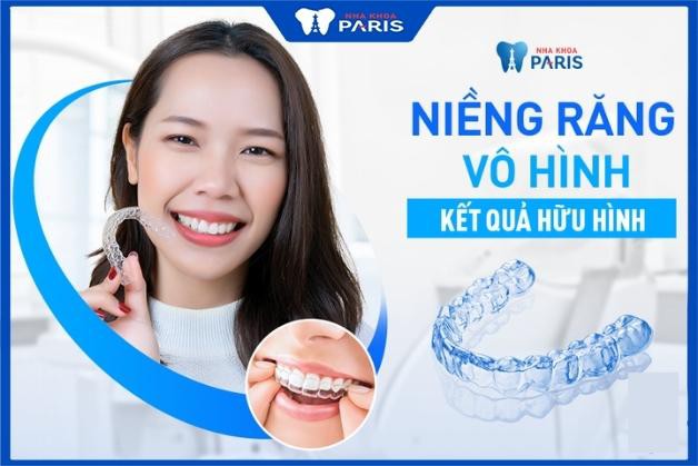 Niềng răng ở Bắc Ninh bằng khay trong - phương pháp cao cấp