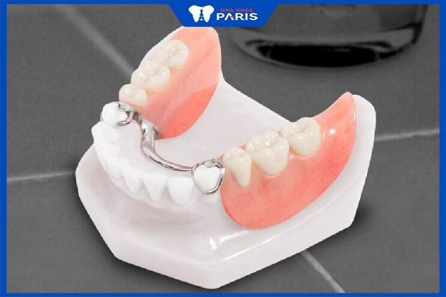 Trồng răng hàm có đau không với hàm tháo lắp?