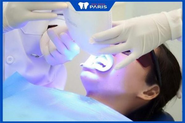 Bác sĩ tẩy trắng răng giỏi ở Hải Phòng – Review từ khách hàng