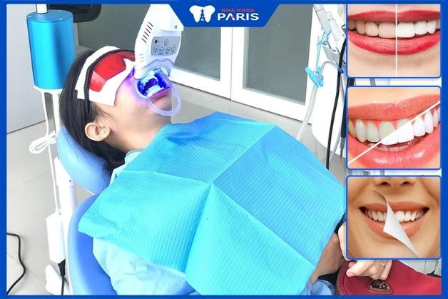Công nghệ tẩy trắng răng WhiteMax tại Nha Khoa Paris