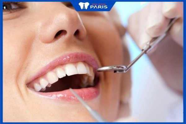 Bao lâu lấy cao răng 1 lần, Tác dụng quan trọng của việc lấy cao răng