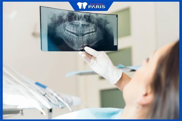Quy trình thực hiện chụp X quang răng tại Nha khoa Paris