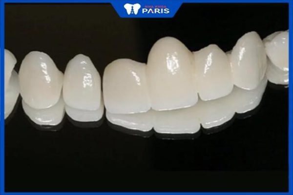 Răng sứ Katana có mấy loại, 4 Đặc điểm nổi bật