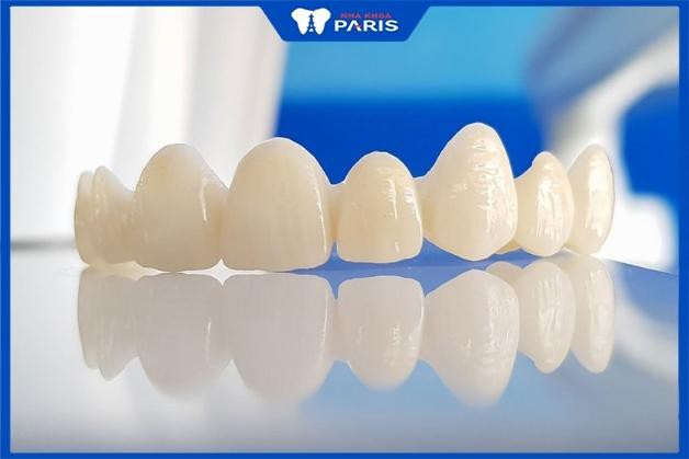 Răng sứ Zirconia sử dụng được bao lâu - Bác sĩ Phạm Thị Hạnh Nha Khoa Paris giải đáp