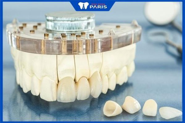 Răng sứ Zirconia sử dụng được bao lâu, chi phí làm răng Zirconia