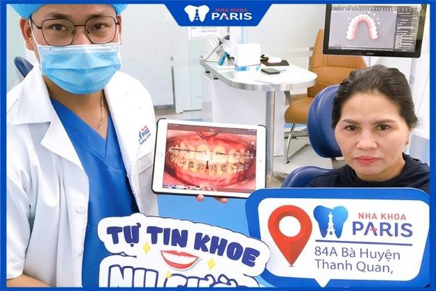 Ưu điểm khi thực hiện niềng răng tại Nha khoa Paris Quận 3