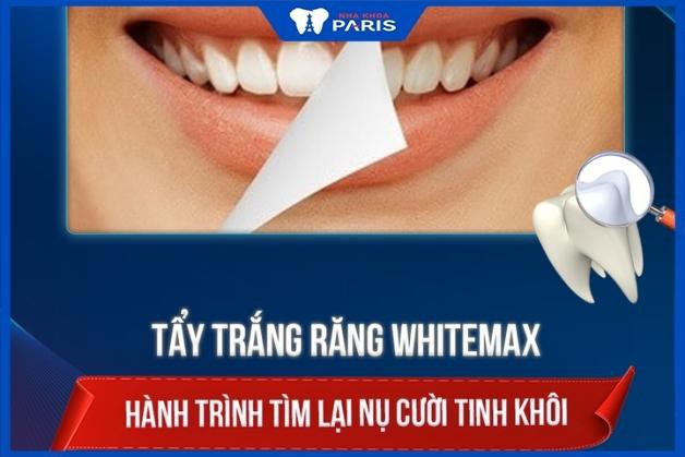 Ưu điểm vượt trội công nghệ tẩy trắng răng WhiteMax