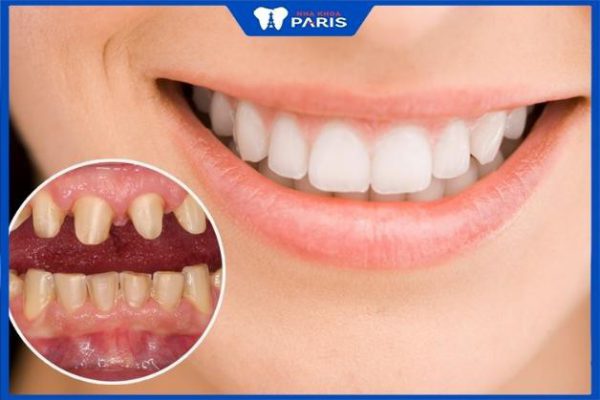 Hé lộ TOP 3 bác sĩ bọc răng sứ tốt ở Buôn Ma Thuột nổi tiếng