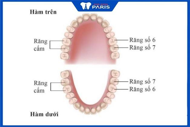 Răng cấm ở vị trí nào trên hàm