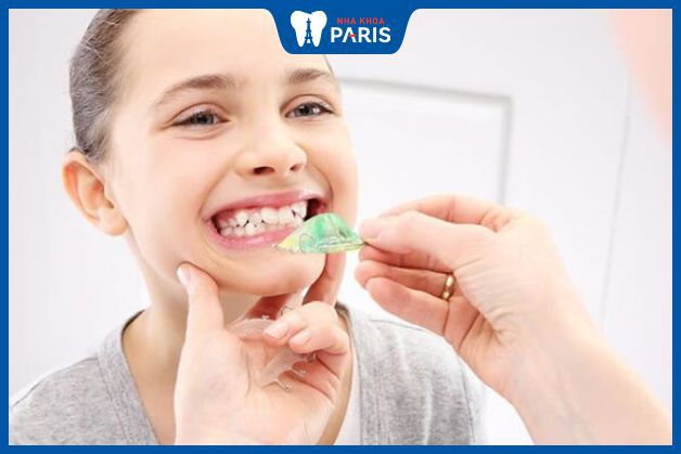 Nên chú ý điều chỉnh hàm răng cho bé từ sớm