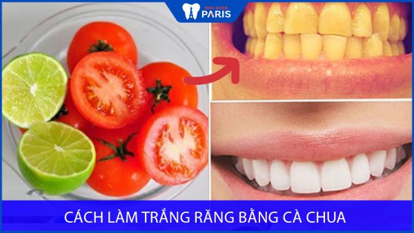 Mách bạn 7 cách làm trắng răng bằng cà chua siêu hiệu quả