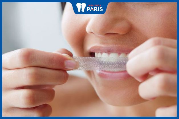 Miếng dán làm trắng răng tiện dụng nhưng cũng tồn tại nhiều nhược điểm