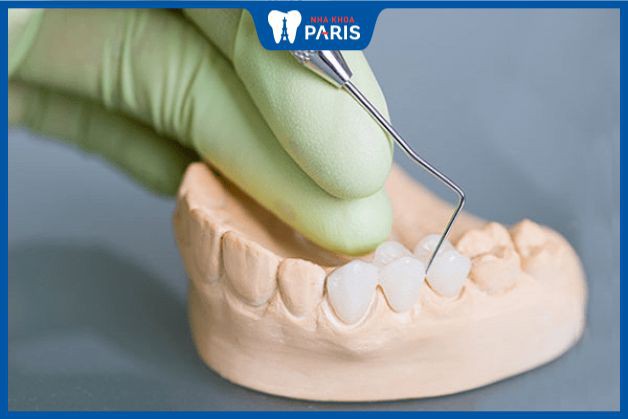 Răng sứ chế tác sai kích thước cũng làm lộ cùi răng thật