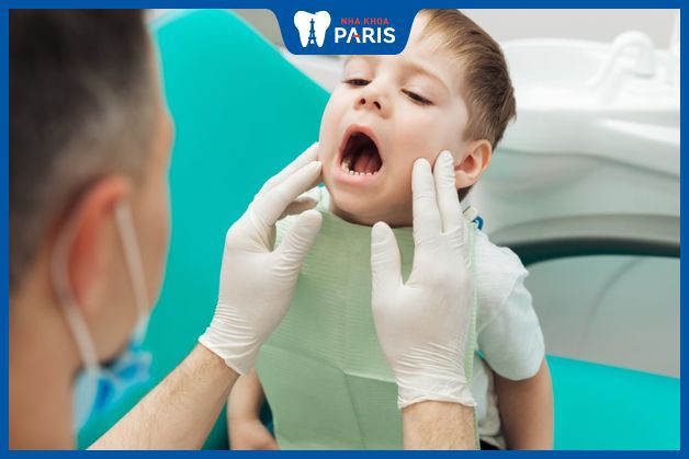 Cách phòng ngừa sâu răng hàm cho bé