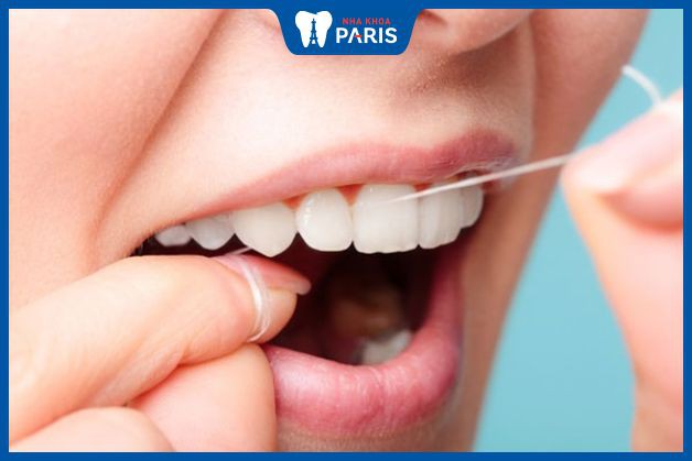 Chỉ nha khoa giúp làm sạch răng miệng hiệu quả mà không gây hại nướu