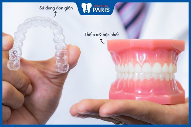 Quy trình thực hiện niềng răng trong suốt Invisalign như thế nào