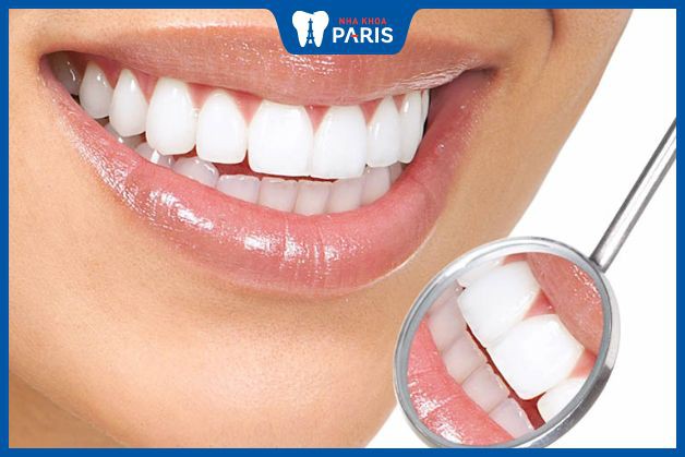 Bọc răng sứ là giải pháp cho răng hô nhẹ