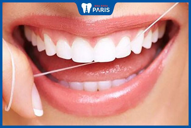 Chỉ nha khoa có thể dễ dàng loại bỏ cặn thức ăn trong kẽ răng