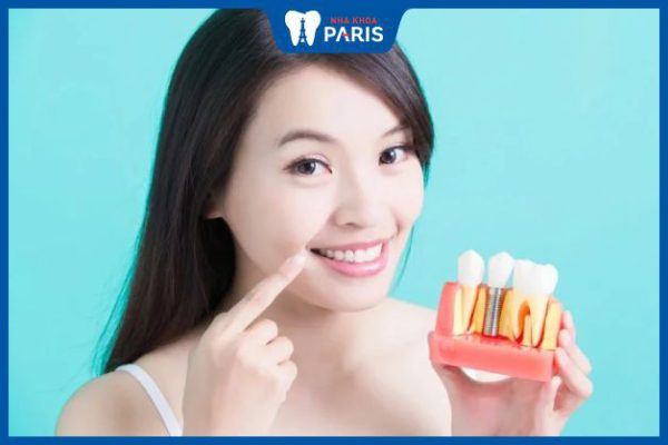 Hướng dẫn cách vệ sinh răng miệng sau khi trồng răng Implant