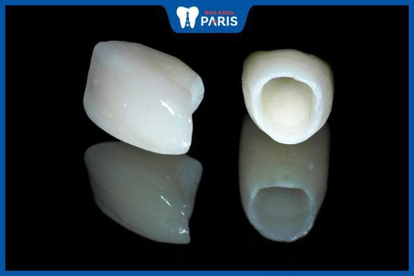 Phục hình răng sứ Cercon có tốt không – Lưu ý khi chăm sóc