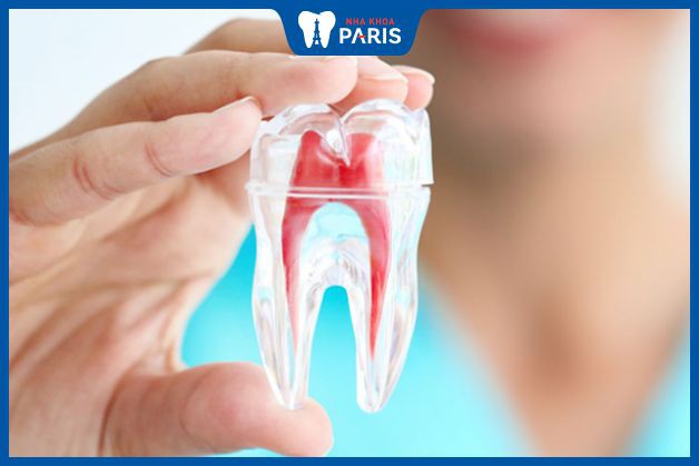 Phương pháp điều trị bệnh lý viêm tủy răng