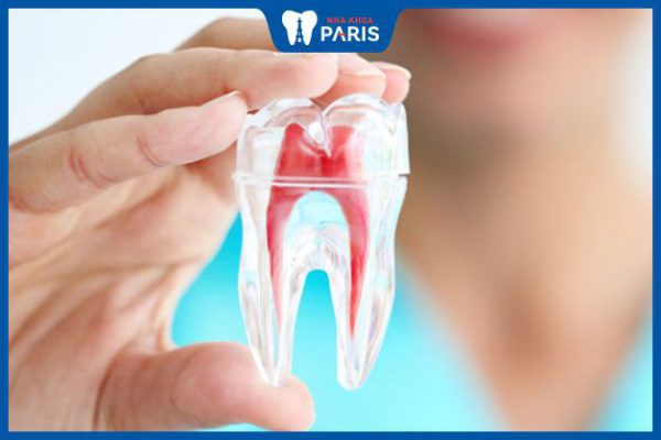 Tại sao có viêm tủy răng? Triệu chứng và cách điều trị hiệu quả