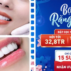 Đặt cọc bọc răng sứ giá tốt nhất năm
