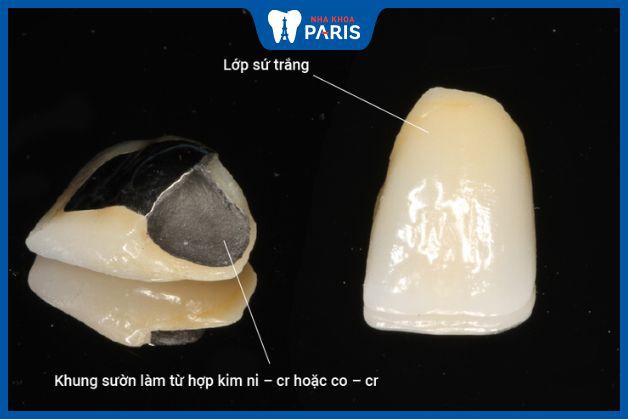 Trường hợp nào trồng răng Implant không thể chụp MRI