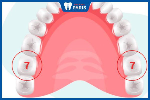 Bác sĩ Nha Khoa Paris trả lời: Nhổ răng số 7 có bị hóp má không