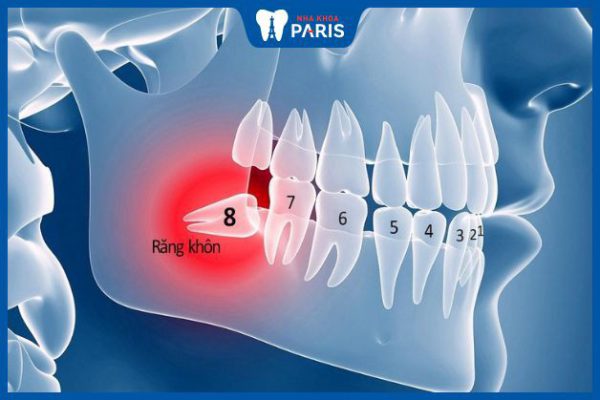 Nhổ răng số 8 xong bị tê lưỡi: Nguyên nhân và cách xử lý