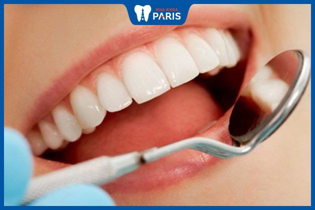 Màu răng sứ phù hợp giúp cải thiện tính thẩm mỹ của hàm răng