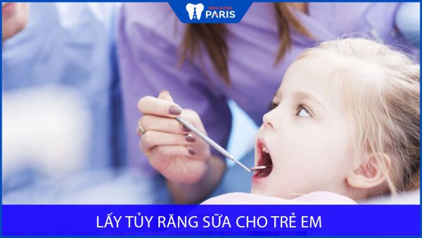 Có nên Lấy tủy răng sữa cho trẻ em không? Cách phòng tránh