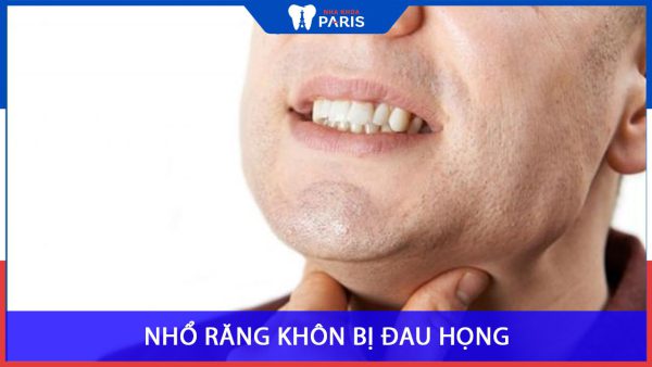 Nhổ răng khôn bị đau họng: Nguyên nhân và cách khắc phục