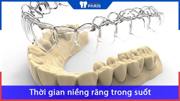 Thời gian niềng răng trong suốt là bao lâu – Nha khoa paris giải đáp