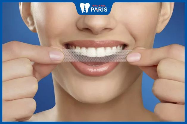 Phương pháp tẩy trắng răng sử dụng miếng dán trắng