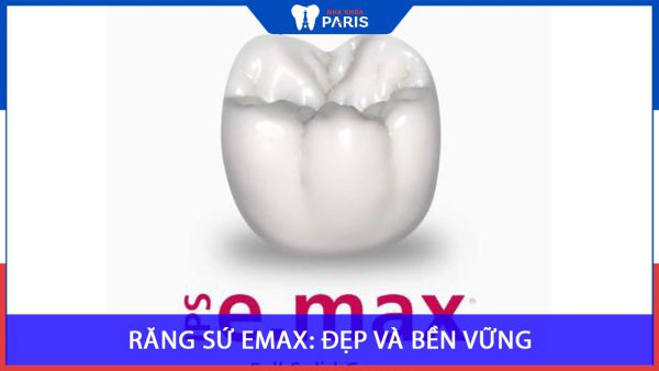 Răng sứ Emax: Đẹp và bền vững? Giảm 70% nguy cơ rạn nứt!