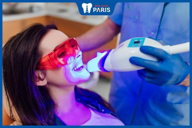 Tẩy trắng răng bằng công nghệ laser